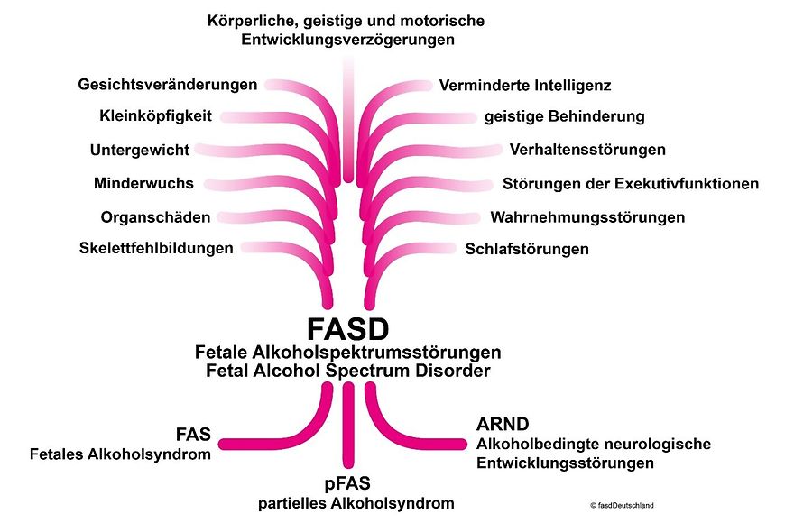 Infografik Fetale Alkoholspektrumsstörungen